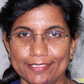 Vijaya L. Vuddagiri, M.D. Louisville, KY Anesthesiology