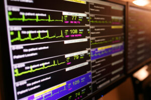 Heart Monitor and Diagnostics