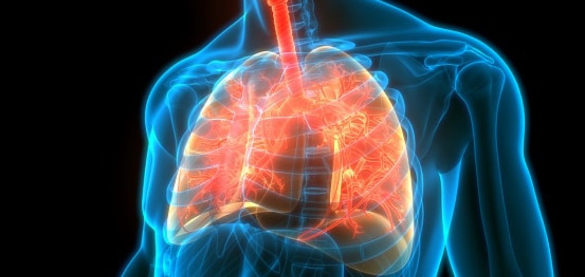 Pulmonary Fibrosis Article