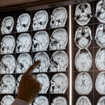 Neurology Brain and Spine 780x350